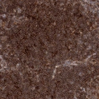 Immunohistochemical staining of human lymph node shows strong membranous positivity in non-germinal center cells.