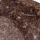 Immunohistochemical staining of human tonsil shows strong membranous positivity in non-germinal center cells.