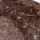 Immunohistochemical staining of human tonsil shows strong membranous positivity in non-germinal center cells.