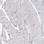 Immunohistochemical staining of human skeletal muscle shows no positivity in myocytes as expected.