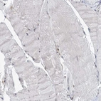 Immunohistochemical staining of human skeletal muscle shows no positivity in myocytes as expected.