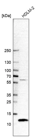 Western blot analysis in human cell line HDLM-2.