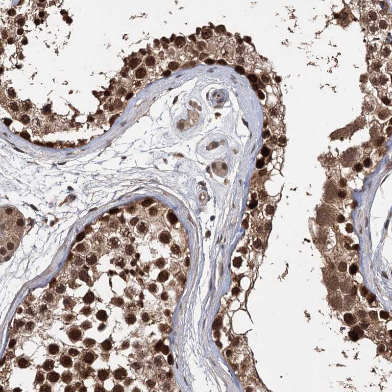 Anti-C12orf10 Antibody