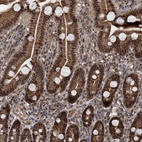 Immunohistochemical staining of human duodenum shows strong nuclear positivity in glandular cells.