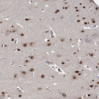 Immunohistochemical staining of human cerebral cortex shows strong nuclear positivity in neurons.