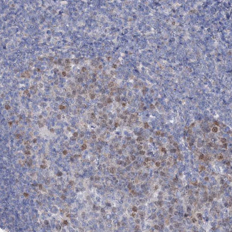 Anti-FAM111B Antibody