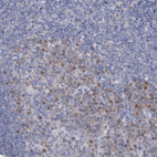 Anti-FAM111B Antibody