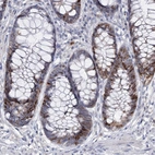 Immunohistochemical staining of human rectum shows moderate nuclear positivity in glandular cells.
