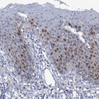 Immunohistochemical staining of human skin shows weak to moderate nuclear positivity in the epithelial cells.