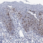 Immunohistochemical staining of human skin shows weak to moderate nuclear positivity in the epithelial cells.