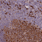 Immunohistochemical staining of human Tonsil shows strong cytoplasmic and membranous positivity in germinal and non-germinal center cells.