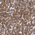 Immunohistochemical staining of human liver shows strong cytoplasmic positivity in hepatocytes.