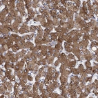 Immunohistochemical staining of human liver shows strong cytoplasmic positivity in hepatocytes.