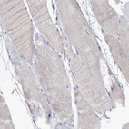 Immunohistochemical staining of human skeletal muscle shows no nuclear positivity in myocytes as expected.