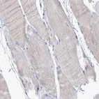 Immunohistochemical staining of human skeletal muscle shows no nuclear positivity in myocytes as expected.
