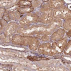 Immunohistochemical staining of human Kidney shows moderate cytoplasmic positivity in cells in tubules.