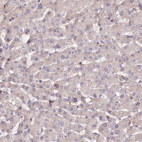 Immunohistochemical staining of human Liver shows very weak cytoplasmic positivity in hepatocytes.