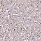 Immunohistochemical staining of human Liver shows very weak cytoplasmic positivity in hepatocytes.