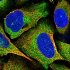 Immunofluorescent staining of human cell line U-2 OS shows positivity in cytoplasm.