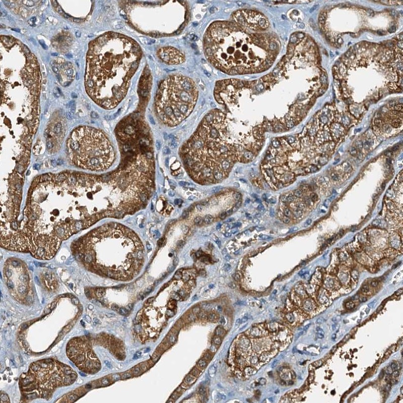 Anti-C10orf90 Antibody