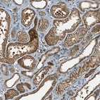Anti-C10orf90 Antibody