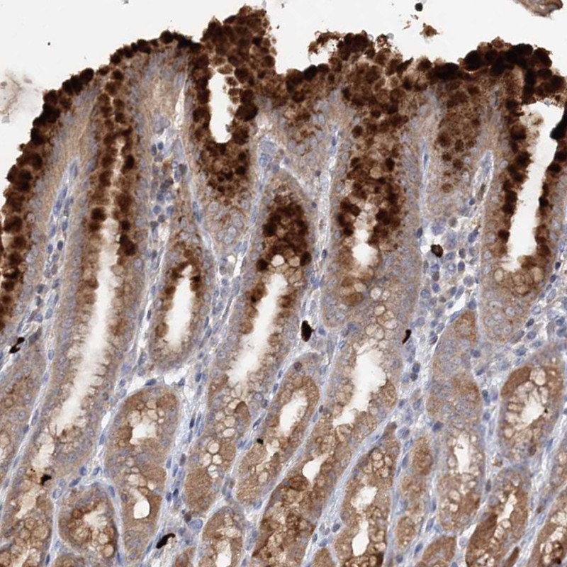 Anti-SLC41A2 Antibody