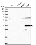 Western blot analysis in human cell line RT-4, human cell line U-251 MG, human plasma and human liver tissue.
