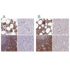 Immunohistochemical staining of human bone marrow, liver, lymph node and pancreas using Anti-BIN2 antibody HPA038667 (A) shows similar protein distribution across tissues to independent antibody HPA038666 (B).