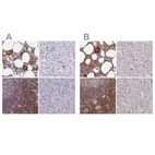 Immunohistochemical staining of human bone marrow, liver, lymph node and pancreas using Anti-BIN2 antibody HPA038667 (A) shows similar protein distribution across tissues to independent antibody HPA038666 (B).