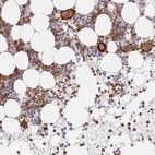 Immunohistochemical staining of human bone marrow shows high expression.