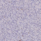 Immunohistochemical staining of human pancreas shows low expression as expected.