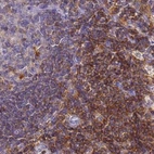 Immunohistochemical staining of human lymph node using Anti-BIN2 antibody HPA038667.
