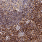 Immunohistochemical staining of human lymph node using Anti-BIN2 antibody HPA038666.