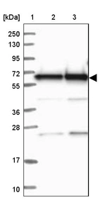 Lane 1: Marker [kDa] 250, 130, 95, 72, 55, 36, 28, 17, 10_br/_Lane 2: Human cell line RT-4_br/_Lane 3: Human cell line U-251MG sp