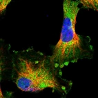 Immunofluorescent staining of human cell line U-251 MG shows localization to plasma membrane & cytosol.
