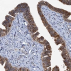 Immunohistochemical staining of human fallopian tube shows strong nuclear and cytoplasmic positivity in glandular cells.