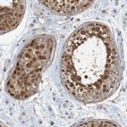 Immunohistochemical staining of human testis shows strong nuclear and cytoplasmic positivity in cells in seminiferous ducts.
