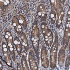 Immunohistochemical staining of human duodenum shows moderate nuclear and cytoplasmic positivity in glandular cells.