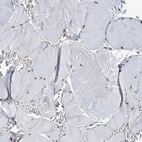 Immunohistochemical staining of human skeletal muscle shows no cytoplasmic positivity in myocytes as expected.