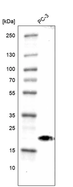 Western blot analysis in human cell line PC-3.