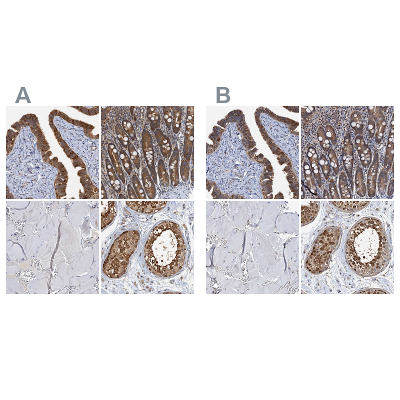 Anti-PTGES3 Antibody