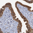 Immunohistochemical staining of human fallopian tube shows strong nuclear and cytoplasmic positivity in glandular cells.