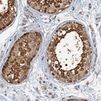 Immunohistochemical staining of human testis shows strong nuclear and cytoplasmic positivity in cells in seminiferous ducts.