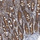 Immunohistochemical staining of human duodenum shows moderate nuclear and cytoplasmic positivity in glandular cells.
