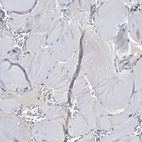 Immunohistochemical staining of human skeletal muscle shows no cytoplasmic positivity in myocytes as expected.