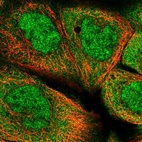 Immunofluorescent staining of human cell line A-431 shows localization to nucleoplasm & cytosol.