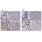 Immunohistochemical staining of human colon, liver, placenta and skeletal muscle using Anti-IKBIP antibody HPA038678 (A) shows similar protein distribution across tissues to independent antibody HPA038677 (B).