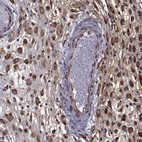 Immunohistochemical staining of human placenta shows high expression.