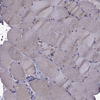 Immunohistochemical staining of human skeletal muscle shows low expression as expected.