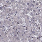 Immunohistochemical staining of human liver using Anti-IKBIP antibody HPA038678.